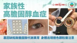最強生命線｜家族性高膽固醇血症：基因缺陷致膽固醇代謝異常　身體出現橙色顆粒需注意｜醫療｜治療｜無綫新聞｜TVB News